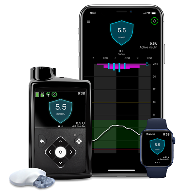 Insulin Pump Therapy